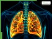 Lung Cancer Symptoms: 5 Warning Signs Of Lung Cancer You Shouldn't Ignore