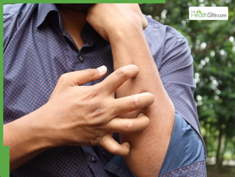 Chicken Is Not For Everyone: 5 Type Of People Who Should Avoid It