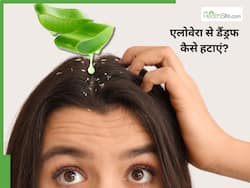 एलोवेरा से डैंड्रफ कैसे हटाए? जानिए लगाने के 5 आसान तरीके