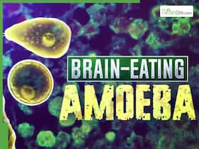 Brain Eating Amoeba With 97% Fatality Rate Found In Treated Drinking Water, Fear Grips Australian Towns Brain Eating Amoeba With 97% Fatality Rate Found In Treated Drinking Water, Fear Grips Australian Towns