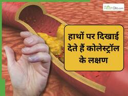 हाथों को देखकर समझ जाएं बढ़ गया है कोलेस्ट्रॉल, बस देना होगा इन संकेतों पर ध्यान