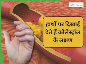 हाथों को देखकर समझ जाएं बढ़ गया है कोलेस्ट्रॉल, बस देना होगा इन संकेतों पर ध्यान