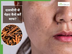 दालचीनी से चेहरा कैसे साफ करें? जानें 5 तरीके, जिससे मिट जाएंगे सारे दाग-धब्बे