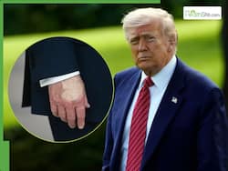 Donald Trump Health Update: US President Appears With Makeup-Smeared Hand, Fueling Rumours Again