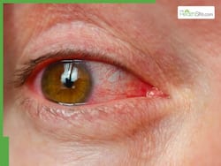 Cancer To High BP: Dangerous Health Conditions Your Eyes Can Reveal | Expert Explains