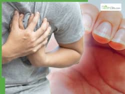 Heart Attack Symptoms: 5 Warning Signs That Appear On Your Nails