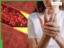 High Cholesterol Symptoms: 7 Warning Signs in Your Fingers That May Indicate High LDL Levels