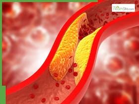 7 Supplements That May Help Lower High Cholesterol