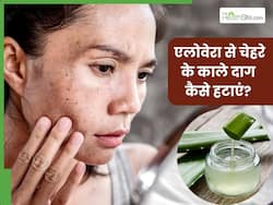 चेहरे के काले दाग हटाने के लिए एलोवेरा कैसे लगाएं? जानें 5 तरीके, जिनसे मिलेगी निखरी और बेदाग त्वचा