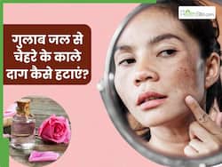 चेहरे के काले दाग हटाने के लिए गुलाब जल कैसे लगाएं? जानें 5 तरीके, जिनसे मिलेगी निखरी-बेदाग त्वचा