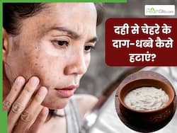 दही से चेहरे के दाग-धब्बे कैसे हटाएं? जानें 5 तरीके, जिनसे मिलेगी निखरी और बेदाग त्वचा