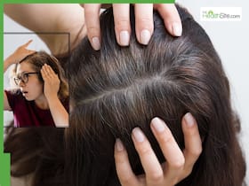 How to Turn Grey Hair Black Naturally: 5 Powerful Home Remedies That Really Work