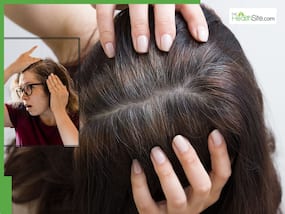 How to Turn Grey Hair Black Naturally: 5 Powerful Home Remedies That Really Work
