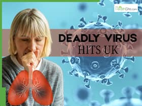 Deadly Sloth Virus Detected In UK For The First Time: All About Oropouche Fever Symptoms Deadly Sloth Virus Detected In UK For The First Time: All About Oropouche Fever Symptoms