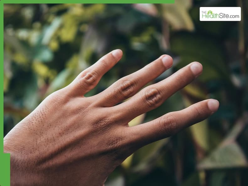 5 Warning Signs of Hypothyroidism Can Show Up In Your Nails