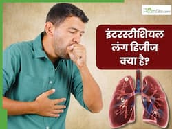 рдЗрдВрдЯрд░рд╕реНрдЯреАрд╢рд┐рдпрд▓ рд▓рдВрдЧ рдбрд┐рдЬреАрдЬ рдХреНрдпрд╛ рд╣реИ? рдЬрд╛рдирд┐рдП рдЗрд╕ рдмреАрдорд╛рд░реА рдХреЗ рд▓рдХреНрд╖рдг, рдХрд╛рд░рдг рдФрд░ рдЗрд▓рд╛рдЬ