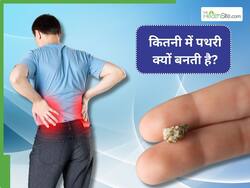 किडनी स्टोन का खतरा बढ़ा देती है ये 5 चीजें, जानिए Kidney Stone में क्या नहीं खाना चाहिए