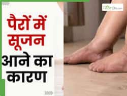 इन 5 कारणों से होती है पैरों में सूजन और दर्द, समय रहते हो जाएं सतर्क