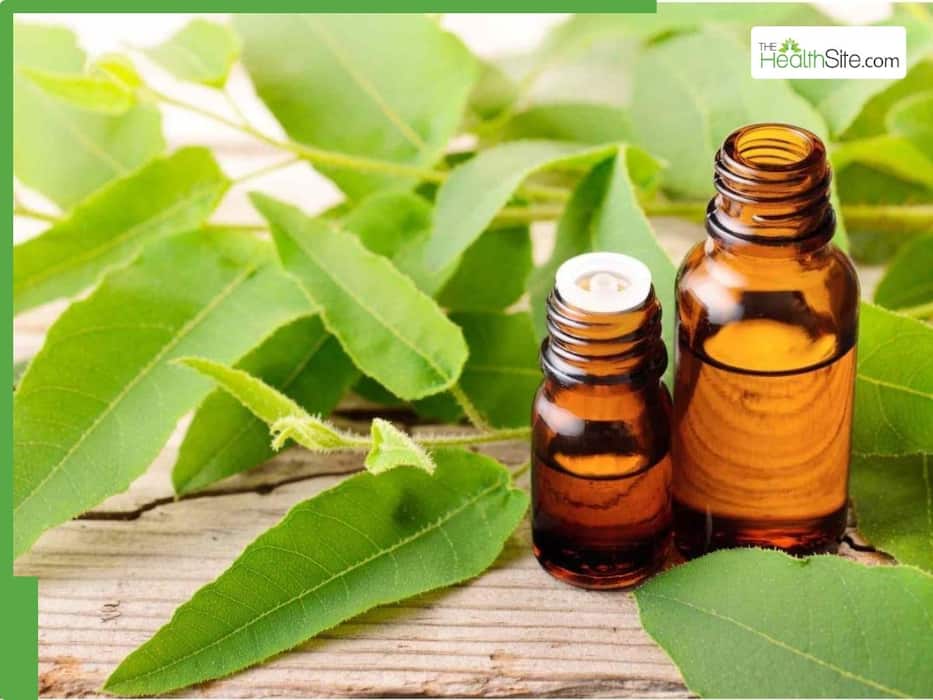 7 Natural Mosquito Repellents To Stay Safe From Dengue And Malaria