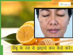 नींबू के रस से झाइयां कम कैसे करें?  रात में सोने से पहले इस तरह लगाएं Lemon juice, स्किन बनेगी बेदाग
