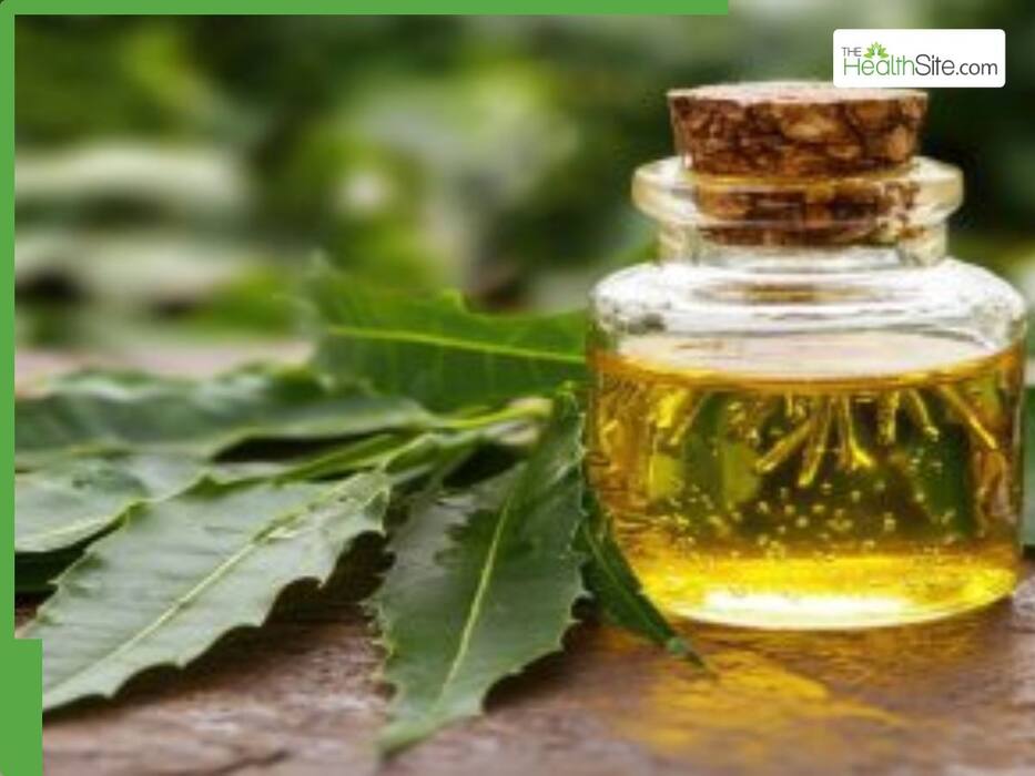 7 Natural Mosquito Repellents To Stay Safe From Dengue And Malaria