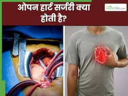 ओपन हार्ट सर्जरी क्या है और कब की जाती है? जानिए इससे जुड़ी अहम जनकारी