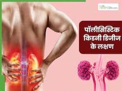 पॉलीसिस्टिक किडनी डिजीज क्या है? जानें इसके कारण, लक्षण और इलाज