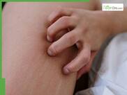 From Fluid Discharge To Redness, Swelling: 5 Signs And Symptoms Of Skin Infections