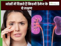 किडनी डैमेज होने पर आंखों में दिखाई देते हैं ये 5 लक्षण, 90 फीसदी लोग साधारण समझकर करते हैं इग्नोर