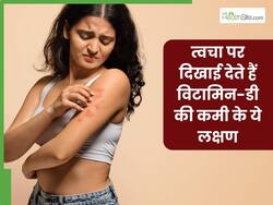 विटामिन डी की कमी होने पर त्वचा पर दिखाई देते हैं ये 4 लक्षण, इग्नोर करने की न करें गलती