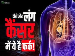 लंग कैंसर और टीबी के बीच कितना फर्क है? देखें ये वीडियो