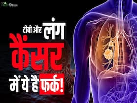 लंग कैंसर और टीबी के बीच कितना फर्क है? देखें ये वीडियो लंग कैंसर और टीबी के बीच कितना फर्क है? देखें ये वीडियो