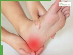 Heel Inflammation And Other Warning Signs Your Feet May Give When Your Liver Is In Complete Danger