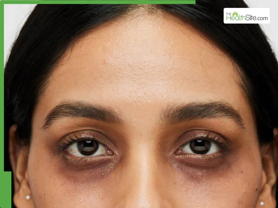 5 Benefits Of Applying Pure Desi Ghee On Face At Night
