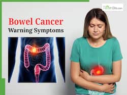 Bowel Cancer Symptoms: 5 Early Warning Signs You Shouldn   t Ignore