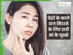 चेहरे के काले दाग मिटाने के लिए दादी मां के ये 5 नुस्खे हैं बेहद असरदार, एक बार में ही मिलेगा रिजल्ट
