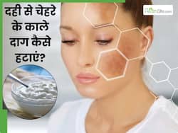 चेहरे के काले दाग हटाने के लिए दही कैसे लगाएं? जानें 5 तरीके, जिनसे मिट जाएंगे सारे दाग-धब्बे