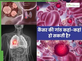 कैंसर की गांठें कहां-कहां बन सकती हैं? ये हैं शरीर के 5 सबसे ज्यादा प्रभावित अंग