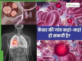कैंसर की गांठें कहां-कहां बन सकती हैं? ये हैं शरीर के 5 सबसे ज्यादा प्रभावित अंग कैंसर की गांठें कहां-कहां बन सकती हैं? ये हैं शरीर के 5 सबसे ज्यादा प्रभावित अंग
