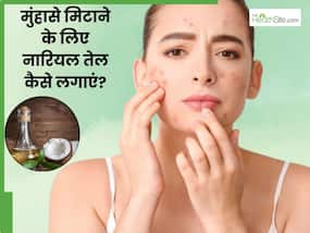 नारियल तेल से चेहरे के मुंहासे कैसे ठीक करें? जानें 5 तरीके, जिनसे मिट जाएंगे सारे एक्ने