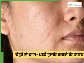 चेहरे से दूर होंगे काले दाग-धब्बे, 5 चीजें हैं असरदार, पहले ही इस्तेमाल में दिखेगा असर चेहरे से दूर होंगे काले दाग-धब्बे, 5 चीजें हैं असरदार, पहले ही इस्तेमाल में दिखेगा असर