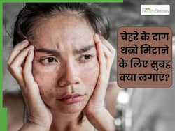 चेहरे के दाग-धब्बे मिटाने के लिए सुबह क्या लगाएं? जानें 5 चीजें, जिनसे मिट जाएंगे सारे धब्बे और झाइयां