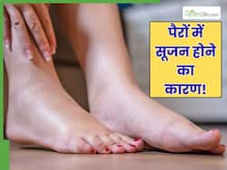 पैरों की नसों में सूजन क्यों होती है? डॉक्टर से जानें 5 कारण जो हर किसी की जिंदगी में हैं आम