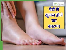 पैरों की नसों में सूजन क्यों होती है? डॉक्टर से जानें 5 कारण जो हर किसी की जिंदगी में हैं आम