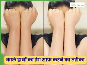 हाथों का कालापन कैसे साफ करें? 3 नुस्खों से शीशे की तरह चमकेगी स्किन