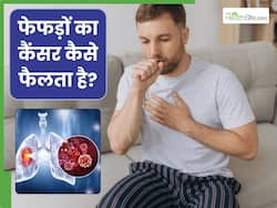 फेफड़ों का कैंसर कैसे फैलता है? जानें इसके लक्षण, कारण और बचाव