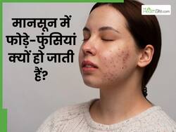 मानसून में क्यों होते हैं फोड़े-फुंसियां? जानिए कारण और सही करने के 5 देसी तरीके