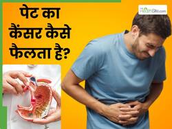 पेट का कैंसर कैसे फैलता है? जानें इसके लक्षण, कारण और बचाव