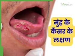 मुंह के कैंसर के शुरुआती लक्षण क्या हैं? ना करें इन 5 संकेतों की अनदेखी