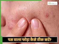 3 असरदार घरेलू नुस्खे जो दूर करेंगे पस वाले फोड़ों की समस्या, तीनों ही है कमाल